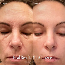 Load image into Gallery viewer, 4-in-1 Red Light Therapy Wand & Activating Serum Kit