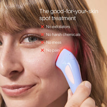 Load image into Gallery viewer, Bye Acne Pro Kit
