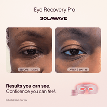 Load image into Gallery viewer, Eye Recovery Pro Kit
