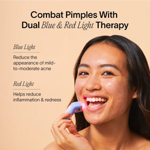 Load image into Gallery viewer, Bye Acne: 3-Minute Pimple Spot Treatment
